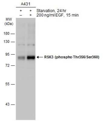 <b>Biological Strategies Validation. </b>Western Blot: RSK3 [p Thr356, p Ser360] Antibody [NBP3-13247] - Untreated (-) and treated (+) A431 whole cell extracts (30 ug) were separated by 10% SDS-PAGE, and the membrane was blotted with RSK3 (phospho Thr356/Ser360) antibody (NBP3-13247) diluted at 1:1000. The HRP-conjugated anti-rabbit IgG antibody (NBP2-19301) was used to detect the primary antibody.